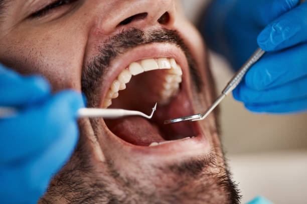 Best Emergency Dentist for Knocked-Out Tooth in Bloomington, IL